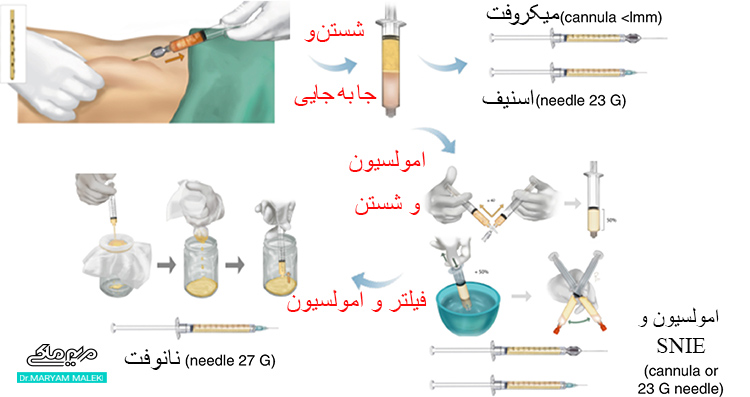 روش نانوفت