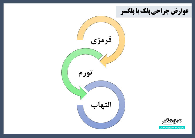 عوارض جراحی زیبایی پلک با پلاسما