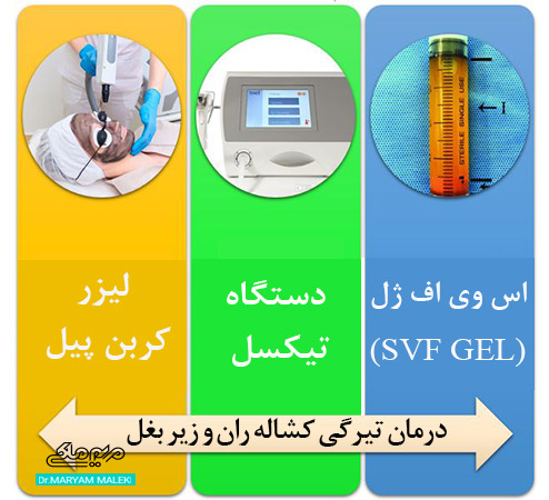 درمان تیرگی زیر بغل و کشاله ران‌ها