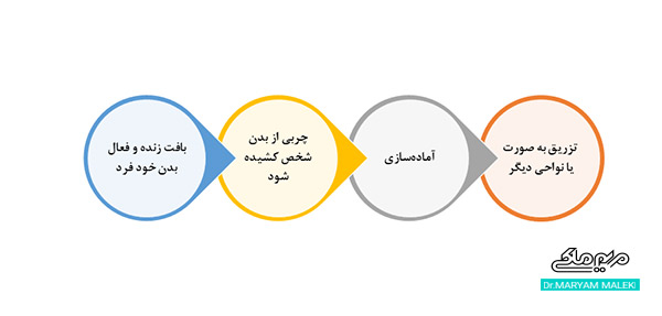 روند تزریق چربی