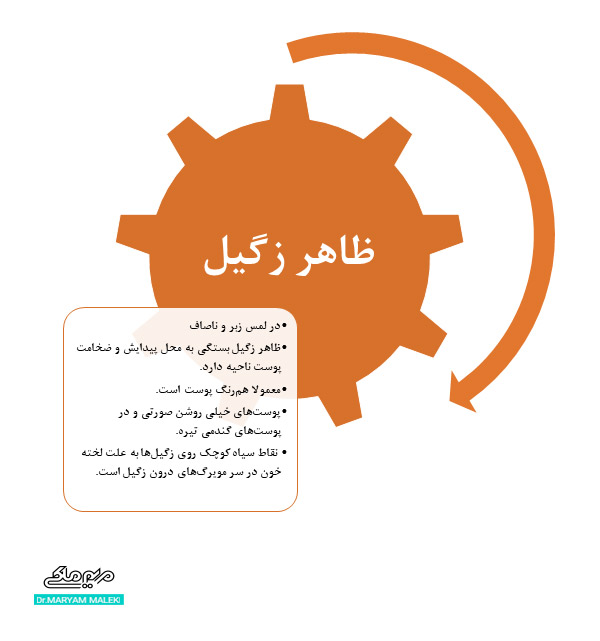 ظاهر زگیل