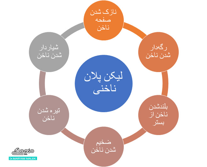 ویژگی‌های  لیکن پلان ناخنی