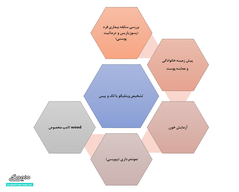 تشخیص ویتلیگو یا لک و پیس