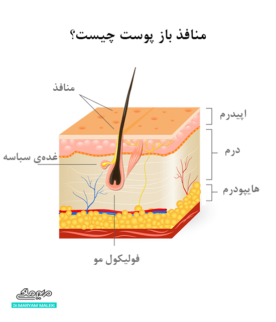 منافذ باز پوست جیست؟