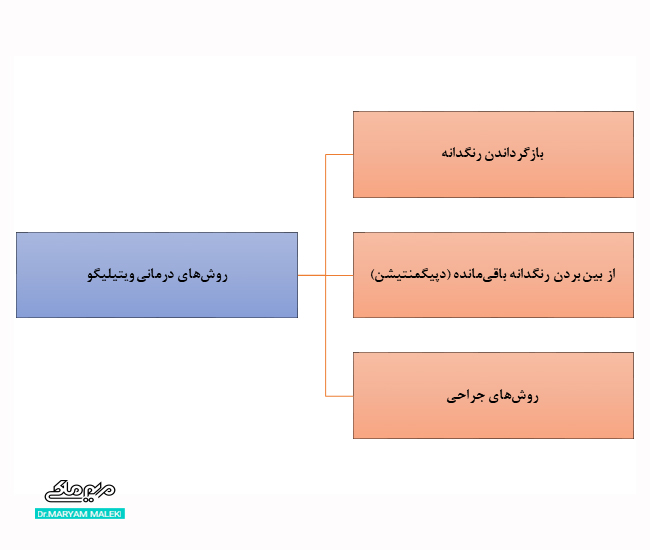  روش‌های درمانی ویتیلیگو