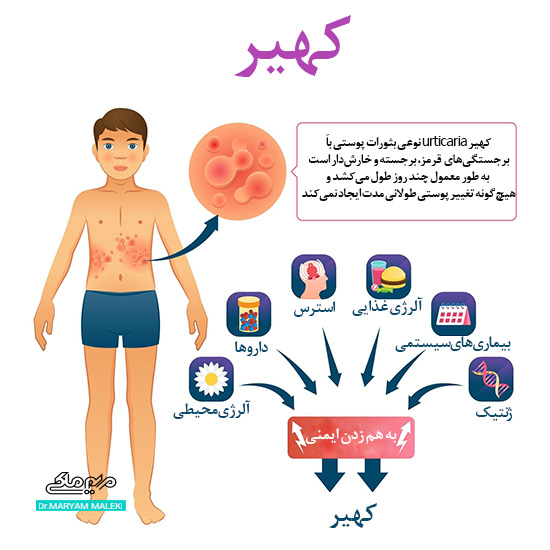 عوامل ایجاد کهیر