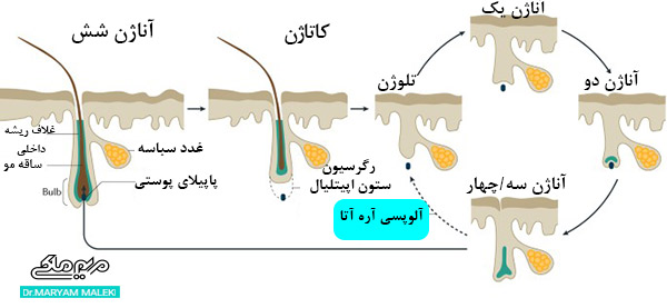 مراحل آلوپسی آره آتا