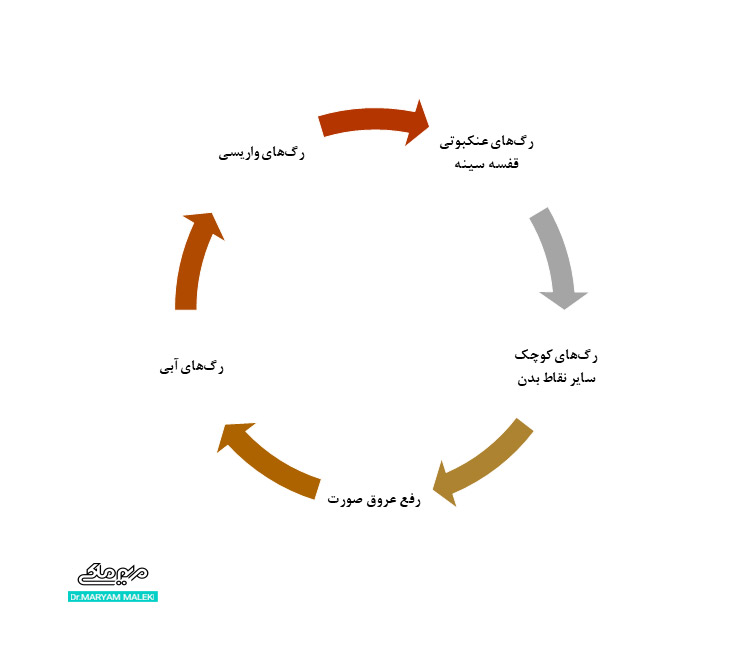  رگ‌های مناسب اسکلروتراپی