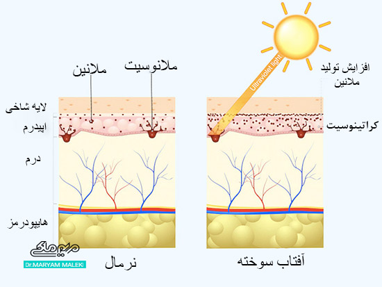 چگونگی ایجاد کک‌ومک