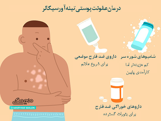 درمان‌ های عفونت پوستی تینه آ ورسیکالر