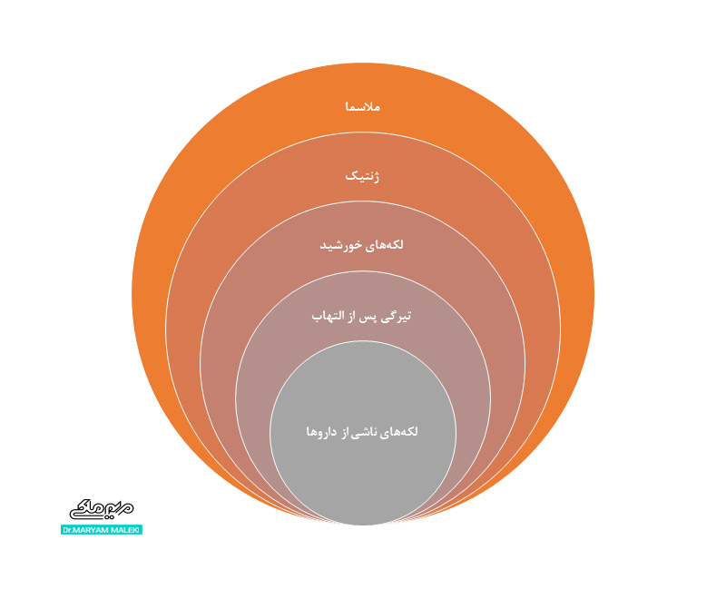 انواع هایپرپیگمنتاسیون 