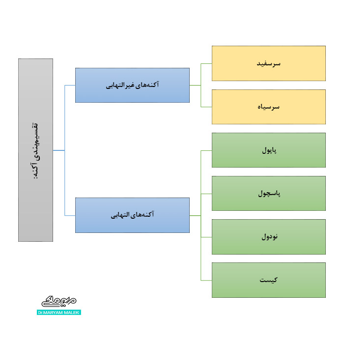 تقسیم بندی انواع جوش