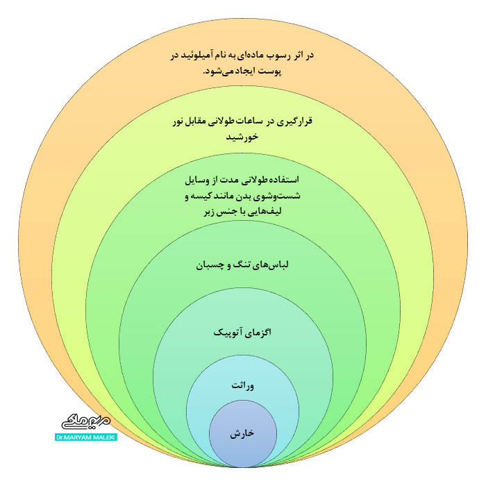 علل ماکولار آمیلوییدوز