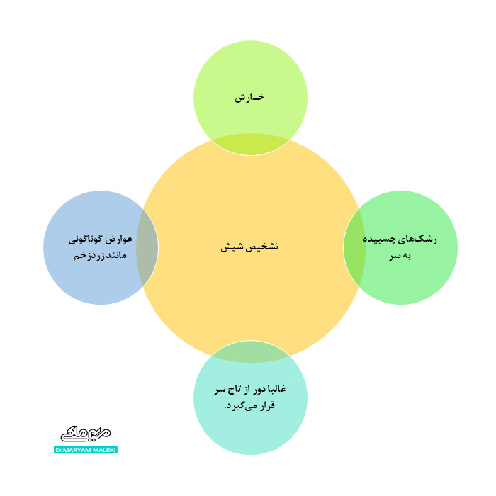 تشخیص شپش سر