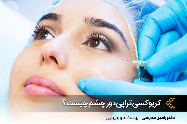 بهترین کربوکسی تراپی دور چشم در اصفهان ، دکتر رامین مدرسی