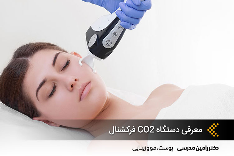 معرفی دستگاه CO2 فرکشنال