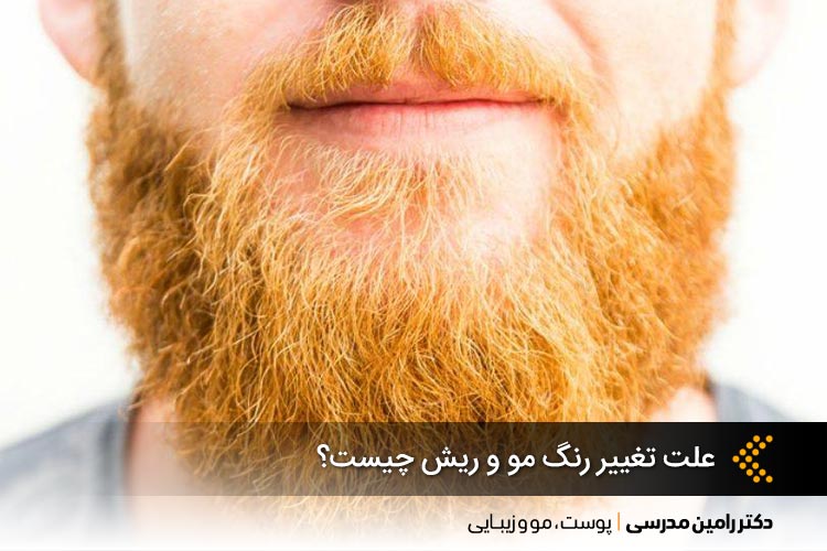 علت تغییر رنگ مو و ریش