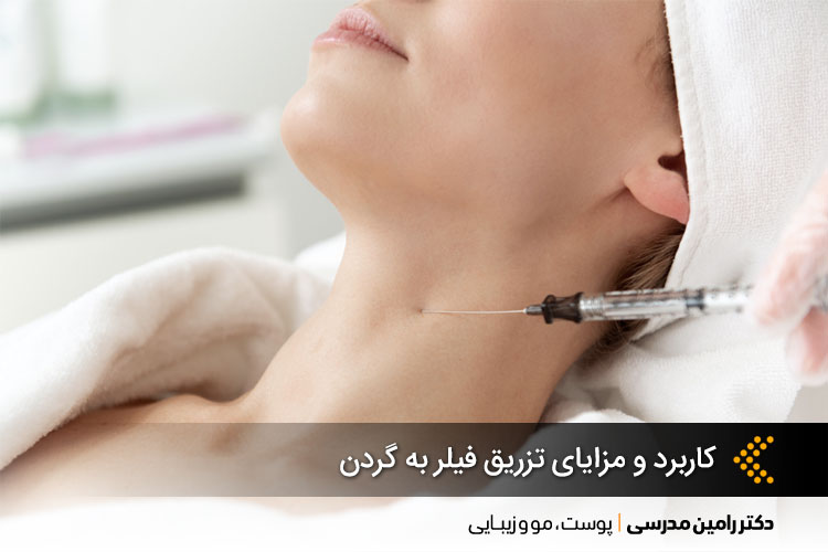 کاربرد و مزایای تزریق فیلر به گردن