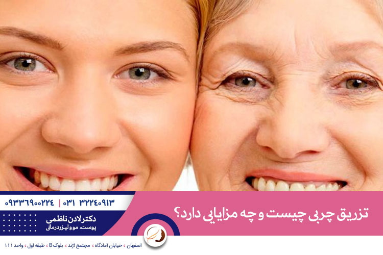 تزریق چربی چیست 