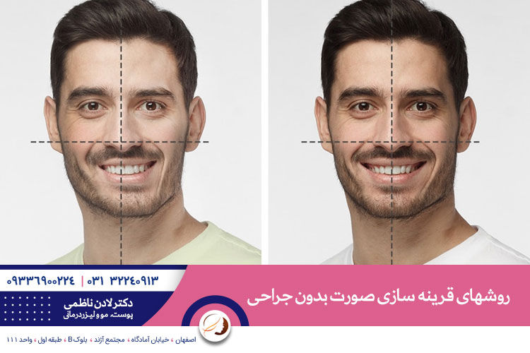 روشهای قرینه سازی صورت بدون جراحی