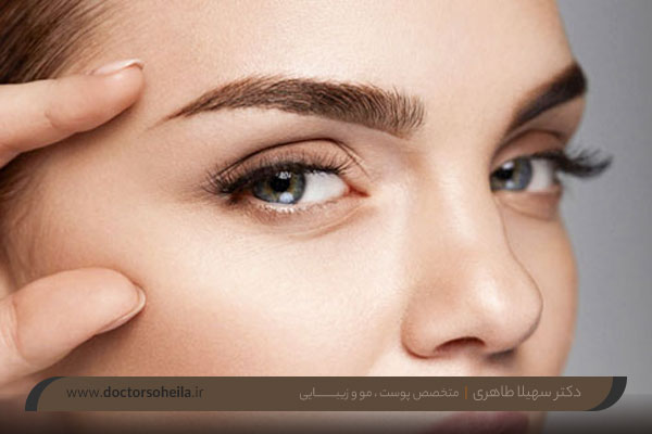 روش های جوانسازی اطراف چشم 