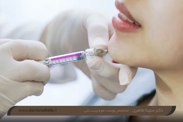 تزریق ژل چانه,بهترین روش فرمدهی چانه