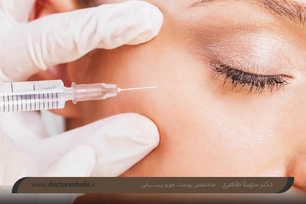 هزینه فیلر زیر چشم