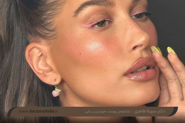 مراقبت بعد از کانتور صورت