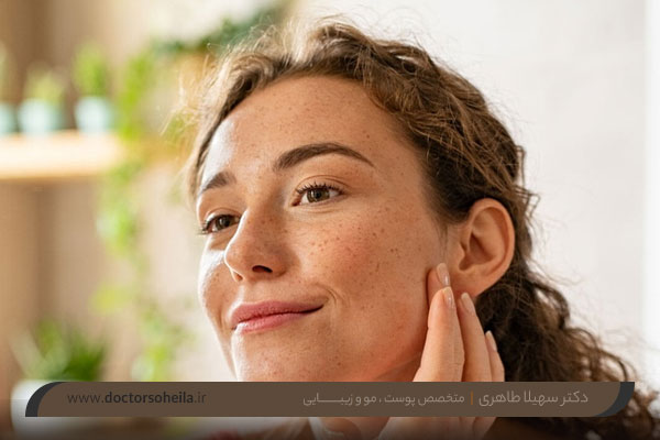 عوارض فیشیال صورت چیست؟