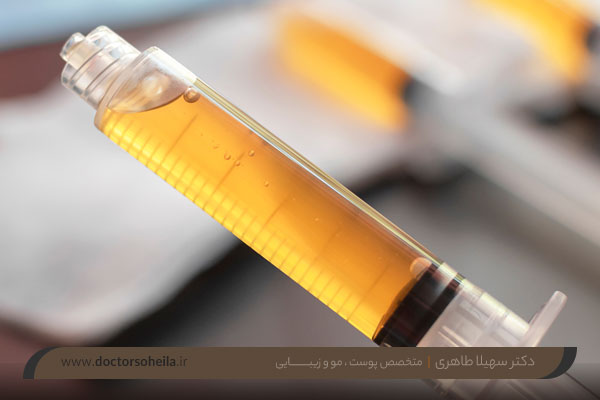 پی آر پی چیست