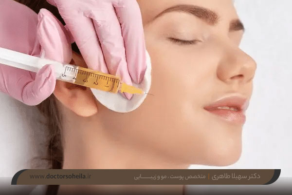 پی آر پی صورت