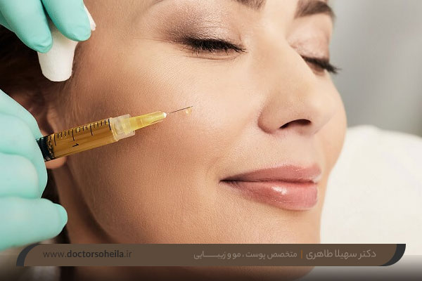 مراقبت های بعد از پی آر پی 