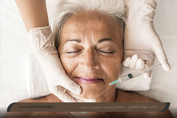 تزریق بوتاکس اصفهان