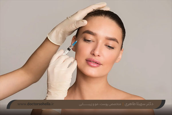 بوتاکس