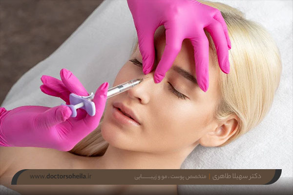 بوتاکس بینی