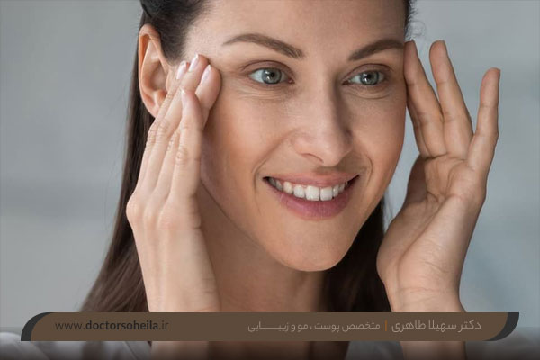 بوتاکس چشم گربه ای