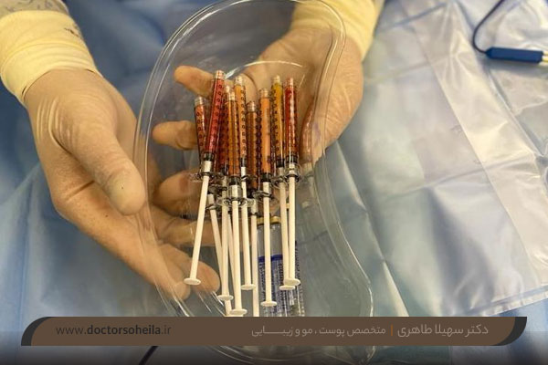 عوارض تزریق چربی به صورت 