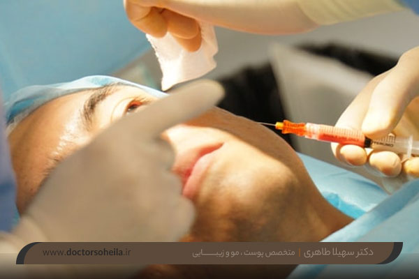 مراقبت بعد از تزریق چربی به صورت