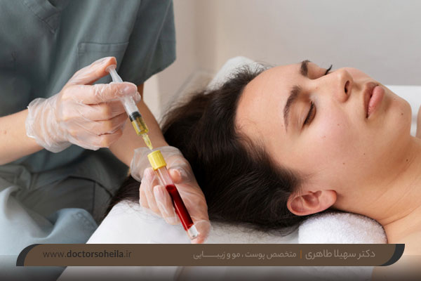 آیا پی آر پی صورت عوارض دارد؟