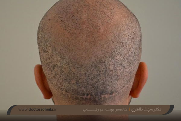 بانک مو