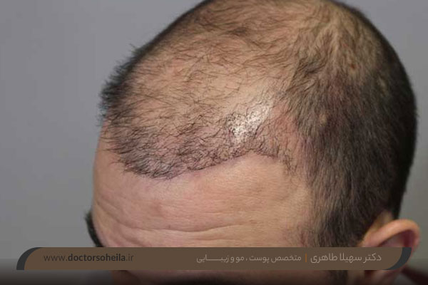 بانک مو چیست؟