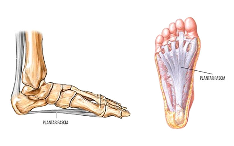 پلانتار فاسیا