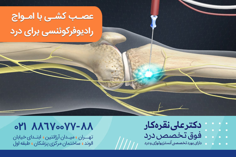 عصب کشی با امواج رادیوفرکوئنسی روشی برای درمان درد