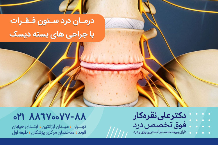 درمان درد ستون فقرات با جراحی بسته دیسک	