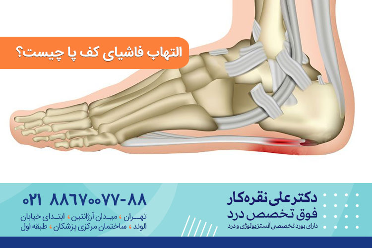 فاشیای پلانتار