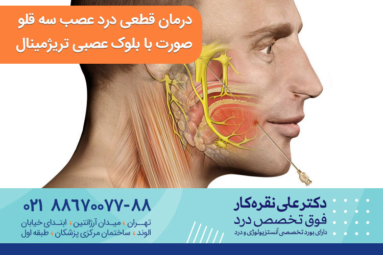 درمان قطعی درد عصب سه قلو صورت