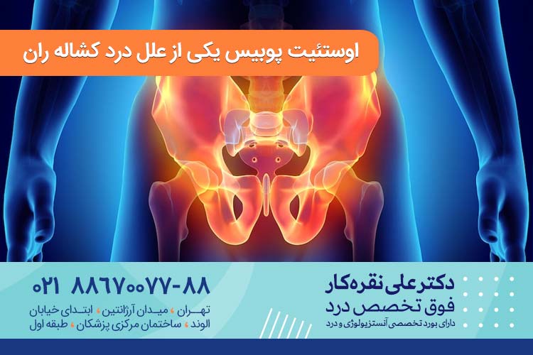 اوستئیت پوبیس یکی از علل درد کشاله ران