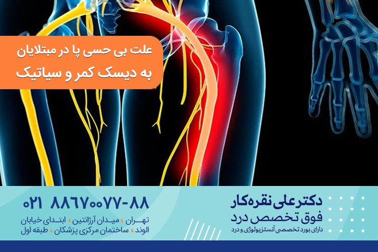 علت بی حسی پا در مبتلایان به دیسک کمر و سیاتیک