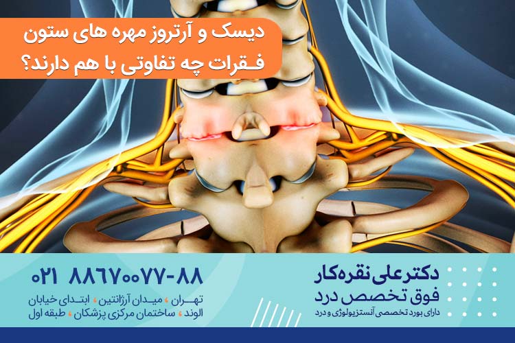 دیسک و آرتروز مهره های ستون فقرات