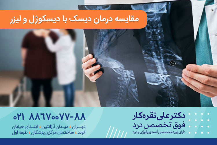 مقایسه درمان دیسک با دیسکوژل و لیزر